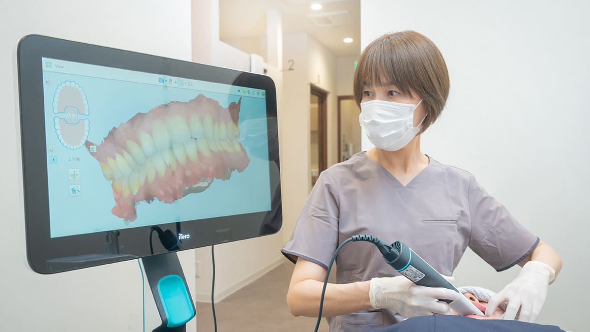 口腔内スキャナー iTero Lumina / SHINING 3D Aoralscan Elite